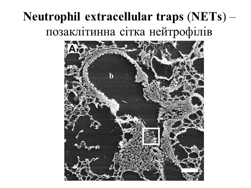 Neutrophil extracellular traps (NETs) – позаклітинна сітка нейтрофілів